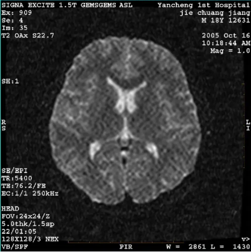 ARTIFACT WI/Fiesta Image White Pixel