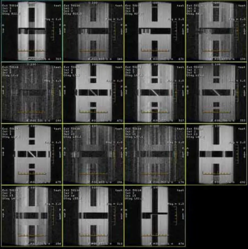 FSE и GRE артефакт